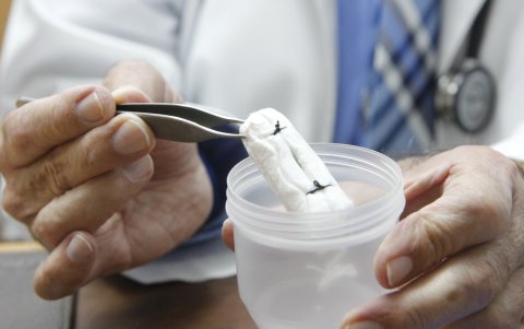 Colector. El colector endometrial con el cual ha logrado analizar a unas 400 mujeres, y ha detectado a tiempo algún cáncer.