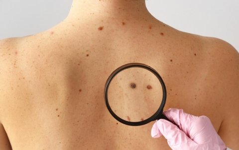 La piel artificial que se utiliza por los investigadores en el estudio consiste en células cutáneas humanas artificiales manipuladas genéticamente.