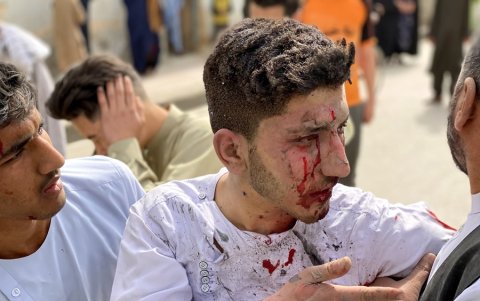 Uno de los heridos en el atentado.