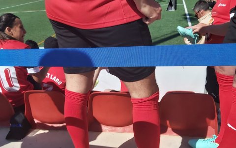 Las piernas del cantante colombiano.