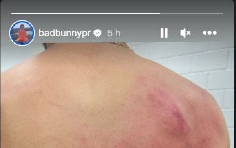 Captura de imagen de la espalda de Bad Bunny.