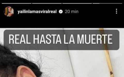 La cantante muestra un moretón en el pómulo sobre la supuesta agresión física por parte de su ex pareja Anuel