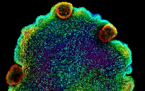 Imagen de microscopía de Trichoplax sp. H2, una de las cuatro especies de placozoos para las que los autores del estudio crearon un atlas celular.