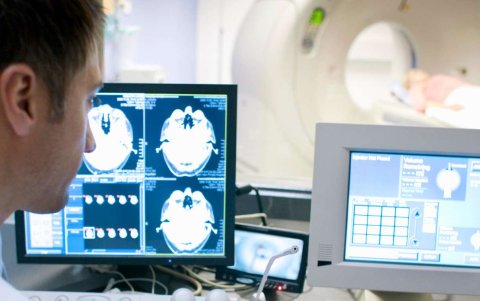 Un especialista revisa placas de tomas de tomografías computarizadas (TAC).