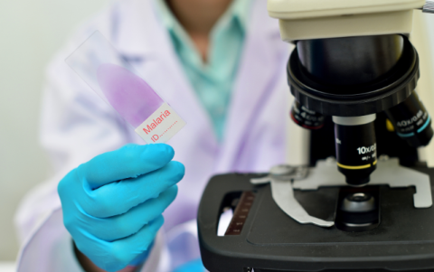 La malaria es una enfermedad transmitida por mosquitos infectados con parásitos del género Plasmodium