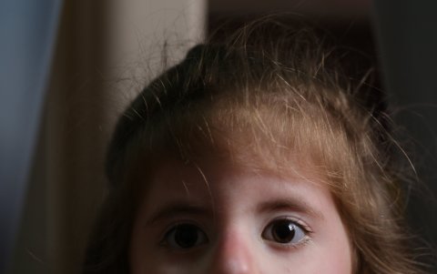 Ana Paula Vera sufre el síndrome de Moebius.