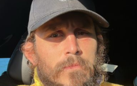 Así luce Chito, a 9 días de la pelea ante O'Malley.