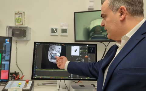 Esta radioterapia inteligente reduce la duración del tratamiento.