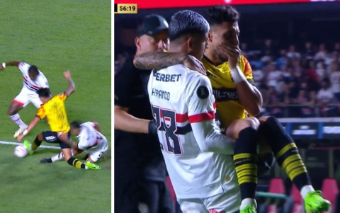 Joao Rojas sufrió una fractura de tibia.