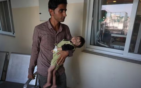 Niños palestinos que sufren desnutrición o enfermedades crónicas como el cáncer.