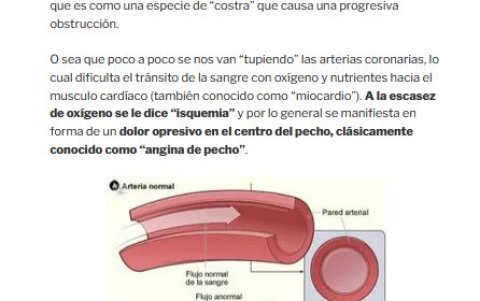 Ilustración sobre problema cardiaco.