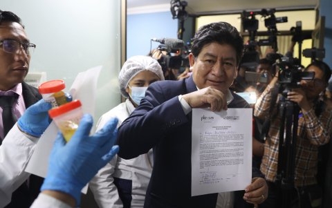 El ministro de Obras Públicas, Edgar Montaño, se dispone a hacerse una prueba antidrogas este martes en La Paz (Bolivia).