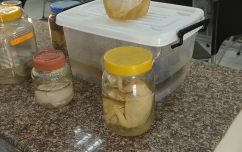 Todos los órganos son reales y han sido donados por diferentes hospitales de la ciudad.