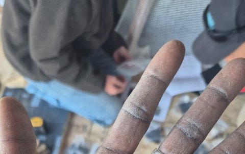 Los callos se han hecho presente en las manos de Erwin Ramírez.