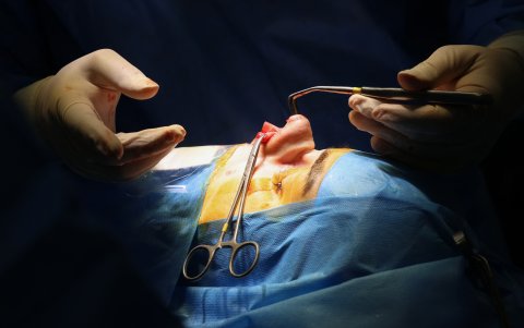 Las ciruguas de la nariz tienen un costo de unos mil dólares en Irán.