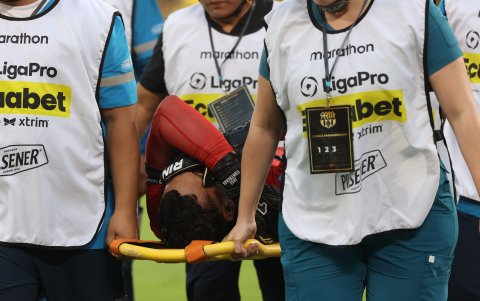 José Contreras fue retirado en camilla al minuto 19 del Clásico del Astillero.