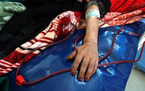 Detalle del brazo de una mujer mientras se somete a un proceso de diálisis.