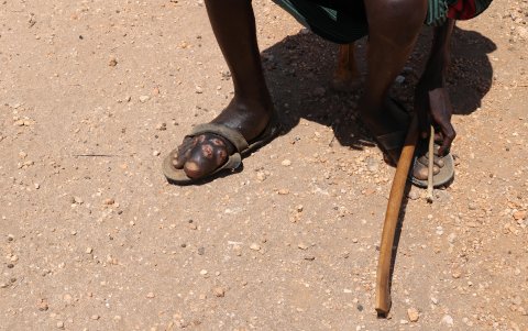 Cuando no consigue su medicación, Jennifer Ekai siente como si algo la 