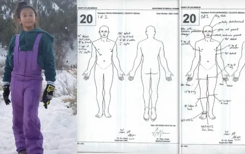 La autopsia de Celeste Rivas también ha relevado la extracción de un ojo y una esqueletización parcial del cráneo.