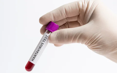 Las autoridades aún no confirman oficialmente un caso positivo de hantavirus en la isla.