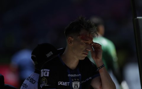 Richard Schunke tuvo que salir de la cancha, porque tenía sangre en la cara.