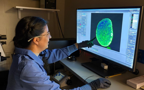 Investigación científica sobre glioblastoma en laboratorio especializado.