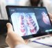 Medics and his staff meet to discuss lungs radiography for patient care strategy in a treatment center. Medical team analyze organs x rays and healthcare records to focus on diagnostics. Close up.