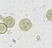 Oocistos de Cryptosporidium, parásito responsable de brotes de diarrea en EE. UU.