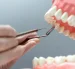 El programa de implantes dentales gratuitos, de la Universidad Católica de Santiago de Guayaquil (UCSG) tendrá 40 cupos.