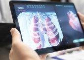 Medics and his staff meet to discuss lungs radiography for patient care strategy in a treatment center. Medical team analyze organs x rays and healthcare records to focus on diagnostics. Close up.