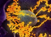 Imagen de microscopio electrónico que muestra (objetos en amarillo) al SARS-CoV-2, el virus que causa el brote del coronavirus COVID-19.