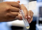 A picture taken on March 31, 2020 shows testing equipment for infectious diseases like the novel coronavirus (Covid-19) in the Microvida laboratory in the Bravis hospital in Roosendaal, The Netherlands, amid the outbreak of COVID-19 (novel coronavirus).  - Netherlands OUT
 / AFP / ANP / Sem VAN DER WAL

 NETHERLANDS-HEALTH-VIRUS