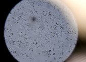 Células infectadas por el nuevo coronavirus, vistas a través de un microscopio en el laboratorio Stabilitech.