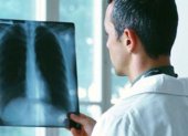 La salud pulmonar también se ve afectada entre quienes sufren de Síndrome Metabólico.