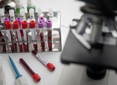 La biotecnológica está usando la tecnología de ARN mensajero para este fin.