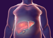 El estudio sugiere que el hígado puede desempeñar un papel en el inicio o la progresión de la enfermedad.