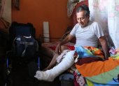 Daño. Desde el 14 de marzo, Reinaldo Acosta permanece con yeso tras caer en una acera, en El Pedregal, en el Guasmo.