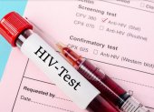 Test VIH