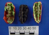 Las caries y las enfermedades de las encías ya acuciaban al hombre hace 10.000 años