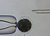 Proceso de clonación de un cerdo modificado genéticamente para reducir el riesgo de rechazo por parte de un receptor humano en un xenotrasplante.