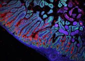Imagen que muestra el intestino delgado humano. Crédito: Grace Burgin, Noga Rogel y Moshe Biton, Observatorio Klarman de Células, Instituto Broad.
