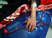 Detalle del brazo de una mujer mientras se somete a un proceso de diálisis.