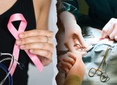 Las mujeres que superaron el cáncer de mama podrán acceder al beneficio en Guayaquil.