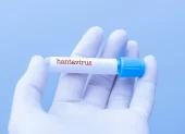 Muestra etiquetada como hantavirus en laboratorio, en medio de la alerta sanitaria internacional por posibles brotes.