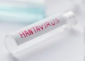Autoridades sanitarias investigan posibles contagios de hantavirus ligados al crucero neerlandés Hondius.