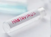 El Reino Unido desplegó una misión aérea para asistir a un residente con síntomas compatibles con hantavirus.