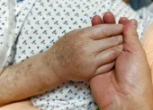 Referencial. Adultos mayores cuestionan la atención y las demoras en hospitales del IESS.