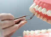 El programa de implantes dentales gratuitos, de la Universidad Católica de Santiago de Guayaquil (UCSG) tendrá 40 cupos.