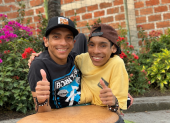 José Luis y José Armando Cevallos, conocidos como los siameses de Ecuador, fallecieron a los 27 años mientras permanecían en Colombia.