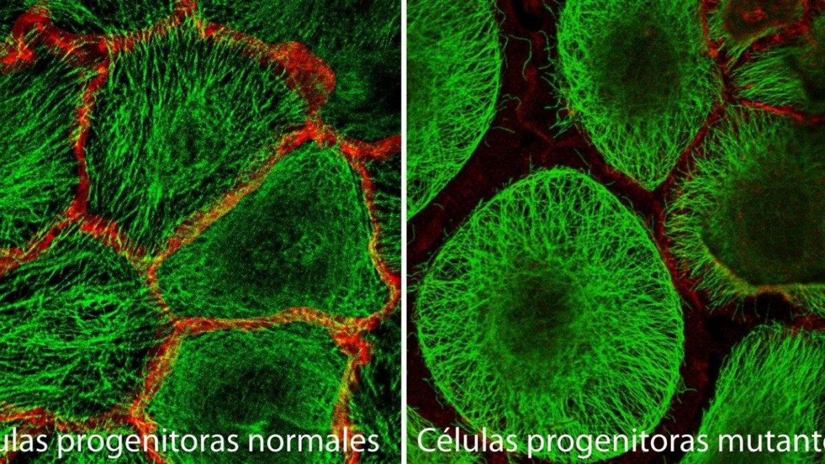 Células progenitoras normales (izquierda) y células progenitoras mutantes mutantes (derecha).